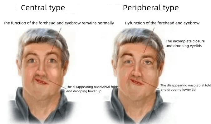 Different-of-central-type -and -peripheral- type
