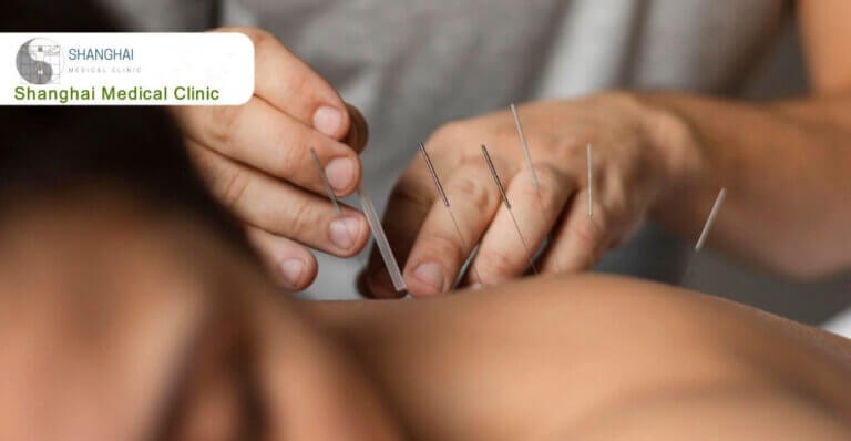 Benefits-of-Acupuncture