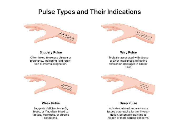 TCM Tongue And Pulse Diagnosis: What They Reveal About Your Health ...