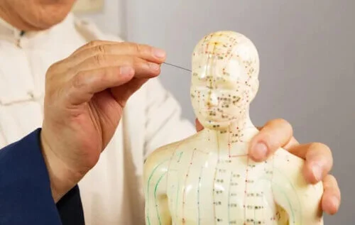 acupuncture-on-the-head